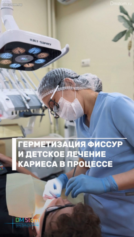 Герметизация фиссур и детское лечение кариеса в процессе. Показания к процедуре.