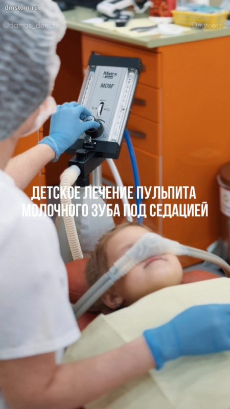 Детское лечение пульпита молочного зуба под седацией. Нюансы лечения зубов детям «во сне»